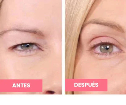 Rejuvenecedor - Palp Lifting Invisible Aurora-Real 