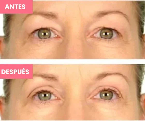 Rejuvenecedor - Palp Lifting Invisible Aurora-Real 