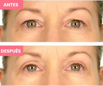 Rejuvenecedor - Palp Lifting Invisible Aurora-Real 