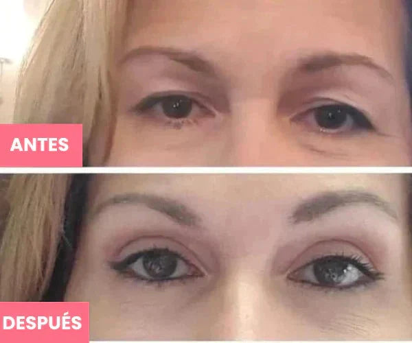 Rejuvenecedor - Palp Lifting Invisible Aurora-Real 